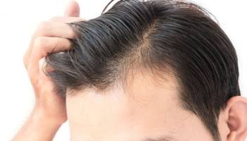 Folicoscopia / Dermatoscopia