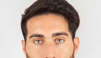 Implante Capilar em Cicatrizes