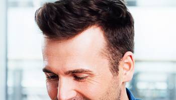 Transplante de Fios Longos