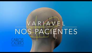 Naturalidade e densidade máxima no transplante capilar- Técnica FUE