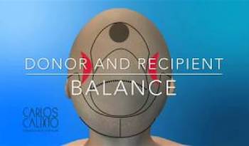 Implante Capilar - Donor and Recipient Balance