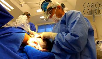 Transplante de Cabelo - Hospital Unique